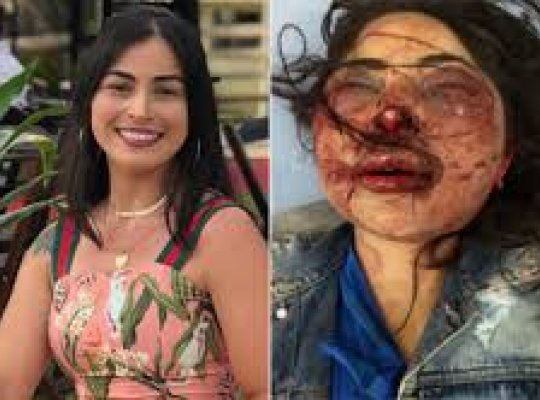 Mulher agredida e abandonada em estrada do ES recebe alta e deixa hospital em Carangola