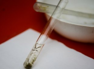 Fiocruz confirma presença do vírus zika em amostras de saliva e urina