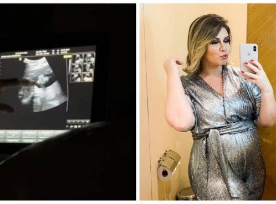 Namorado de Marília Mendonça exibe ultrassom do filho do casal; cantora fala sobre gravidez