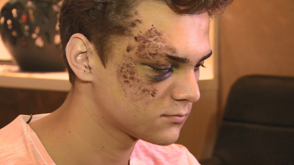Estudante é atingido por pedra no rosto enquanto lanchava com amigos e vai para UTI, em Vitória