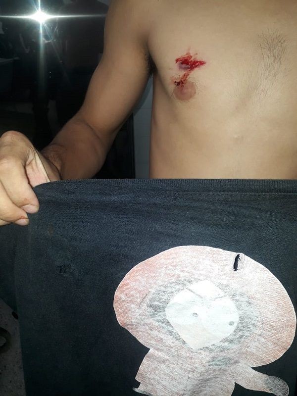 Estudante é baleado ao se negar a entregar o celular em Vila Velha