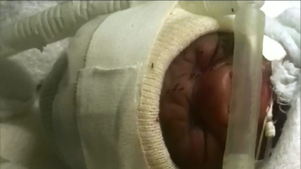 Servidores denunciam infestação de formiga em incubadora neonatal de maternidade de BH